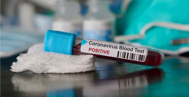 5 Consigli per gli appuntamenti per la pandemia di Coronavirus